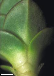 Veronica epacridea. Connate leaf bases, of the variant form found at Mt Cook and in N. Otago, which lack characteristically thickened leaf margins and midvein. Scale = 1 mm.
 Image: W.M. Malcolm © Te Papa CC-BY-NC 3.0 NZ